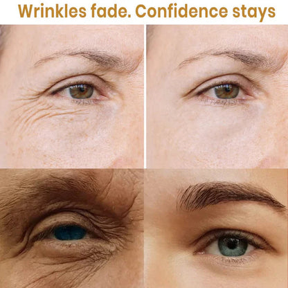 Lutein Anti wrinkle Serum _ New Younger Skin in Days